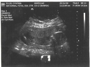 4th_ultrasound_17_weeks.jpg