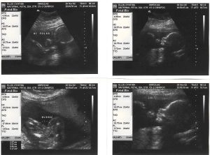 5th_ultrasound_21_weeks.jpg